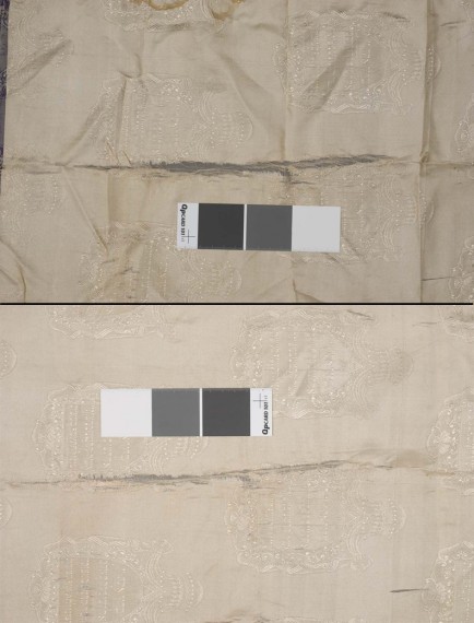 Stabilization of a tear with an underlay: before treatment on the top, after treatment on the bottom